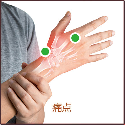 痛風(fēng)/肌腱炎/腱鞘炎/腫脹等貼敷位置示意圖