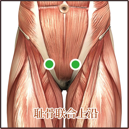 盆腔炎、尿道炎、宮頸炎、陰道炎等婦科疾病貼敷位置示意圖